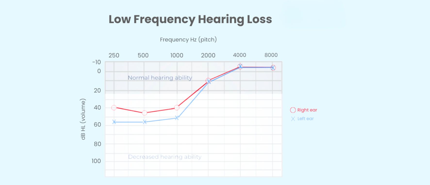 Understanding Reverse-Slope (Low Frequency) Hearing Loss: Causes, Symptoms, and Treatment | Aanvii Hearing